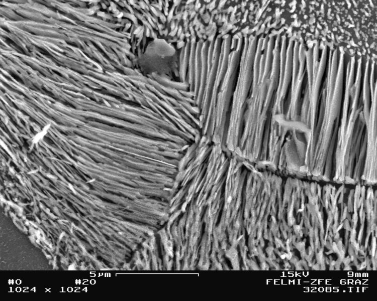 Bild 3: Zementitlamellen in Perlit bei unlegiertem Gusseisen mit Kugelgrafit, Wanddicke 50 mm, 5000:1, geätzt