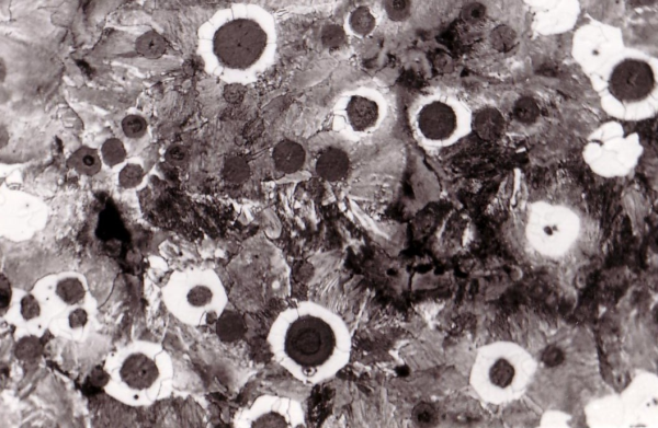 Bild 1: Ferrithöfe bei perlitischem Gusseisen mit Kugelgrafit, 100:1, geätzt