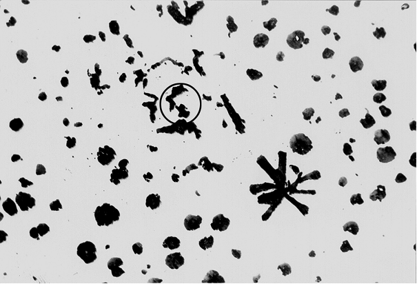 Fig. 4: Graphite degeneration, whose cause cannot be identified from this image, magnification 100:1, not etched 
